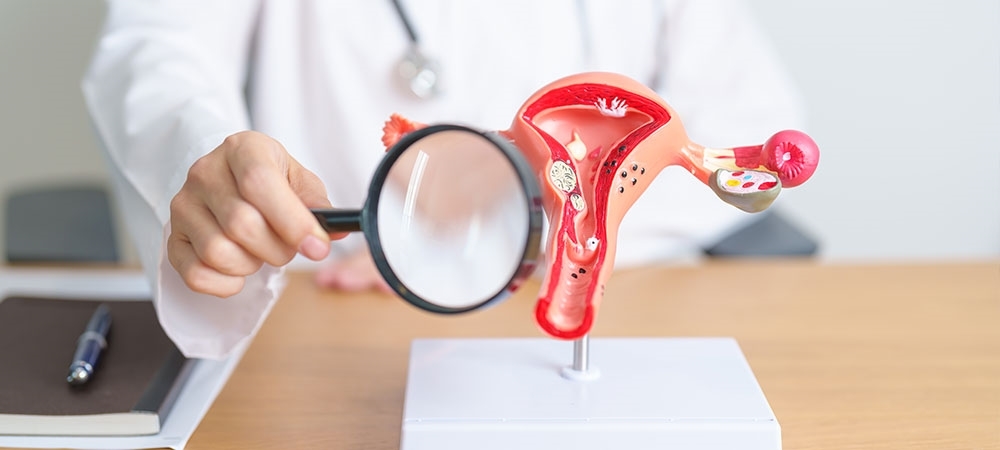 Polip nedir? Polip belirtileri nelerdir?