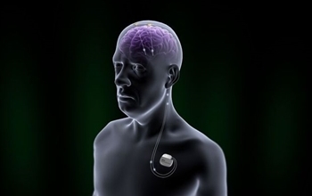 Parkinson Tedavisinde Beyin Pili Yöntemi 