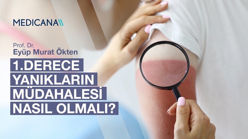 1. Derece Yanıkların Müdahalesinde Ne Yapmamız Gerekmektedir?