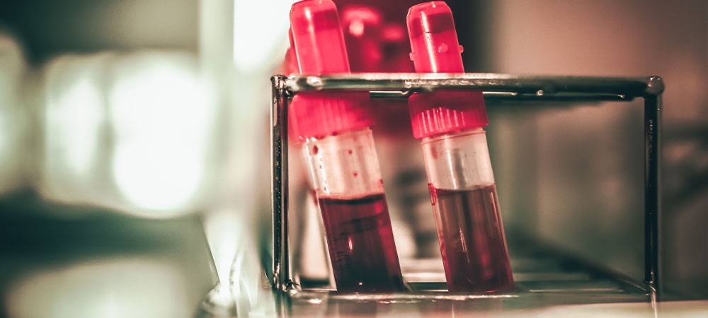 Kan gazı nedir? Kan gazı değeri kaç olmalı?