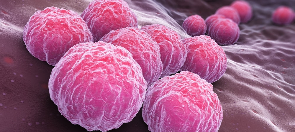 Bel soğukluğu belirtileri nelerdir? Bel soğukluğu nasıl geçer?