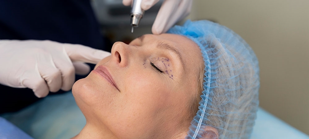 Fibroblast nedir? Fibroblast kaç seans yapılır?