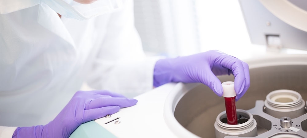 Estradiol nedir? Estradiol yüksekliği/düşüklüğü ne anlama gelir?