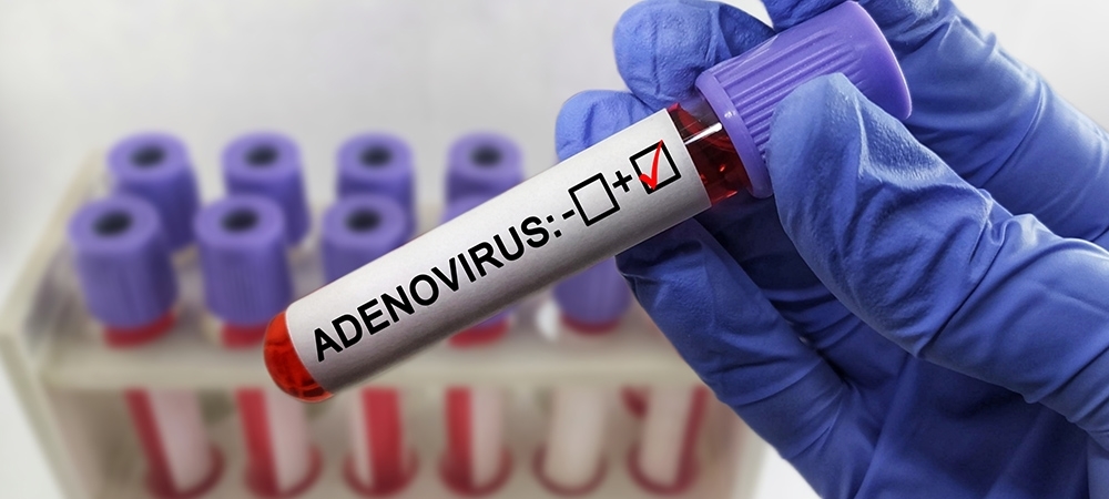 Adenovirüs nedir? Adenovirüs kaç günde geçer?