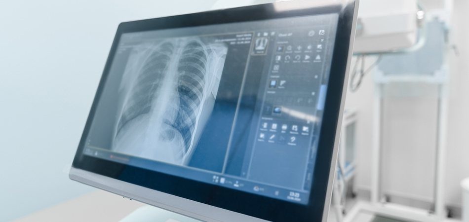 Akciğer grafisinde ne görülür? Sağlıklı akciğer grafisi nasıl olmalı?