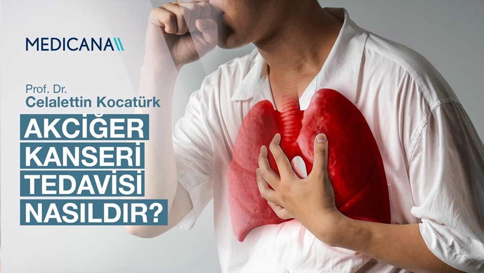 Akciğer Kanseri Tedavisi Nasıldır?