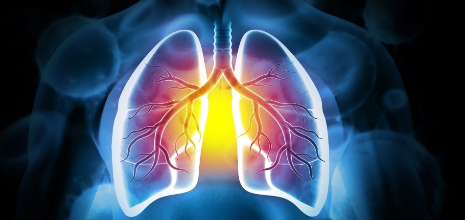 Akciğerin su toplaması nedir? Plevral efüzyon belirtileri nelerdir?