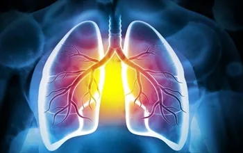 Akciğerin su toplaması nedir? Plevral efüzyon belirtileri nelerdir?