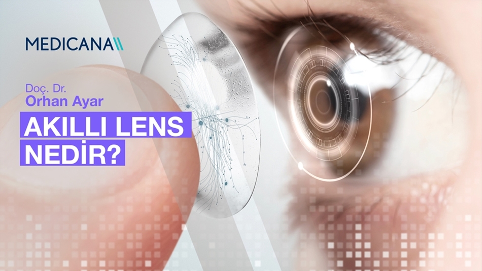 Akıllı Lens Nedir?
