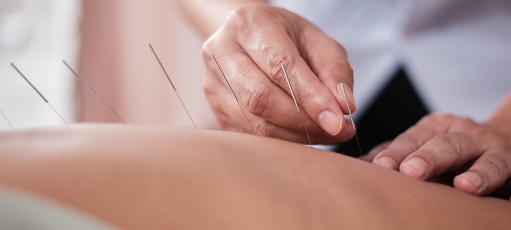 Akupunktur ile 1 ayda kaç kilo verilir? Akupunktur ne işe yarar?