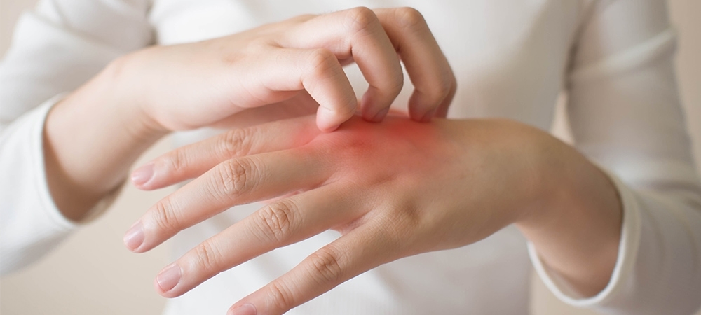 Alerjik kaşıntı nedir? Alerjik kaşıntının belirtileri neler?