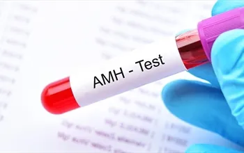 AMH testi nedir, ne zaman yapılır?