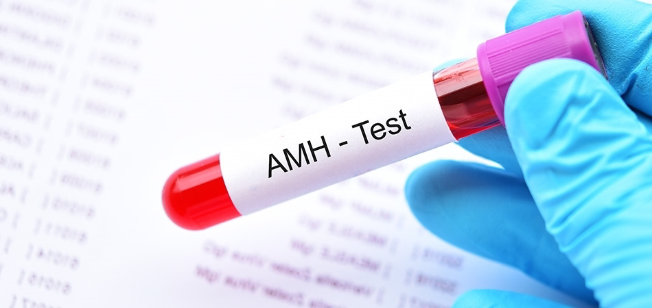 AMH testi nedir, ne zaman yapılır?