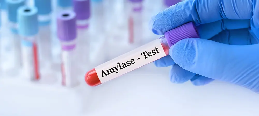 Amilaz ne demek? Amilaz değerinin yüksekliği ve düşüklüğü ne anlama gelir? Amilaz ne demek? Amilaz değerinin yüksekliği ve düşüklüğü ne anlama gelir?
