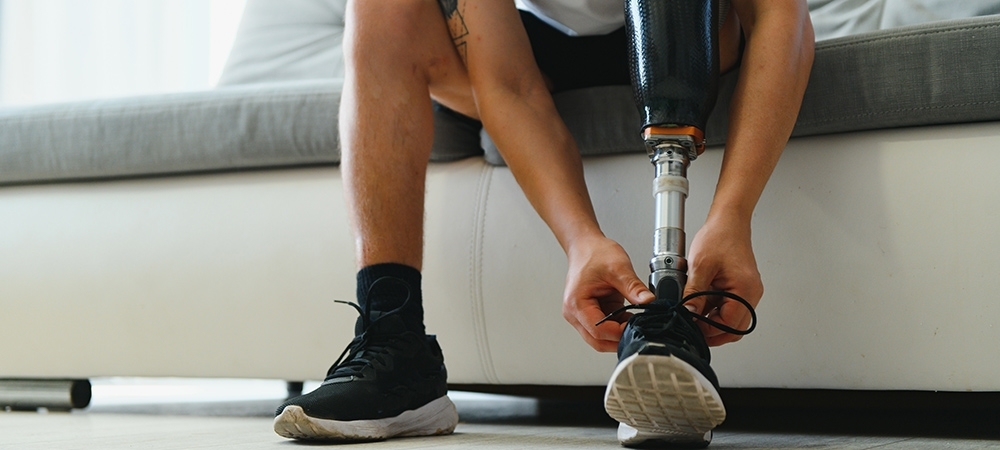 Ampüte ne anlama gelir? Ampütasyon neden yapılır?