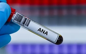 ANA testi: Nedir, ne zaman istenir ve sonuçlar nasıl yorumlanır?