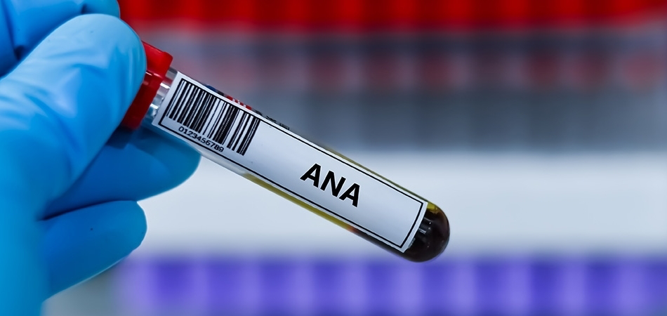 ANA testi: Nedir, ne zaman istenir ve sonuçlar nasıl yorumlanır?