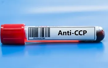 Anti-CCP: Nedir, ne zaman istenir ve sonuçlar nasıl yorumlanır?