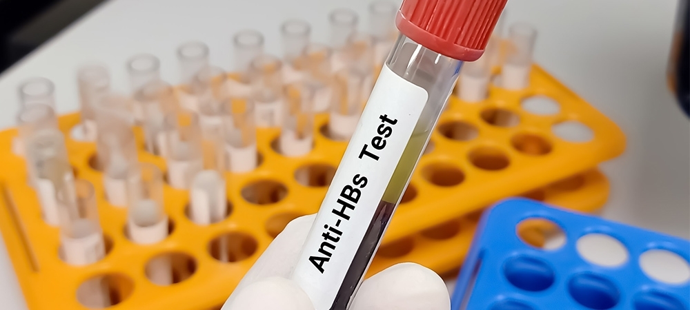 Anti HBs yüksekliği ne anlama gelir? Anti HBs değeri kaç olmalı?