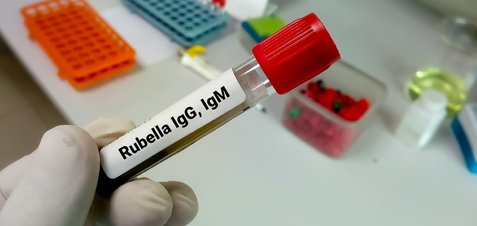Anti-rubella IgG ne demek? Anti-rubella IgG yüksekliği ne anlama gelir?