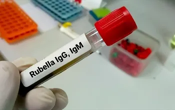 Anti-rubella IgG ne demek? Anti-rubella IgG yüksekliği ne anlama gelir?