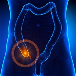 Apandisit Nedir?