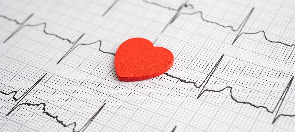 Aritmi (kalp ritim bozukluğu) nedir? Aritminin belirtileri nelerdir?