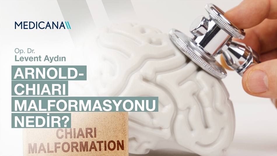 Arnold-Chiari Malformasyonu Nedir?