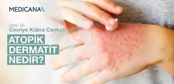 Atopik Dermatit Nedir?