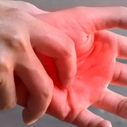 Avuç İçi Yanması ve Kaşınması