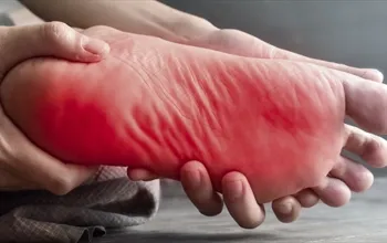 Ayaklarda yanma neden olur? Ayaklarda yanma nasıl geçer?