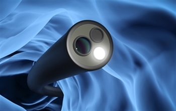 Kolonoskopi Nedir, Çeşitleri Nelerdir?