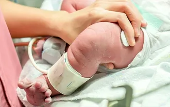 Bebeklerde hipoglisemi nedir? Hipoglisemi neyin belirtisi olabilir?