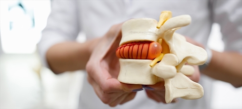 Bel fıtığı nedir? Bel fıtığı belirtileri ve tedavisi