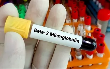 Beta 2 mikroglobulin nedir? Yüksekliği ve düşüklüğü ne anlama gelir
