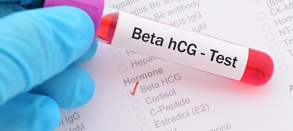 Beta HCG kaç olunca gebelik pozitiftir?