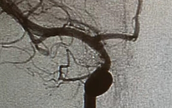 Ölümcül inat sonu oluyordu