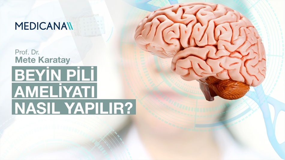 Beyin Pili Ameliyatı Nasıl Yapılır?