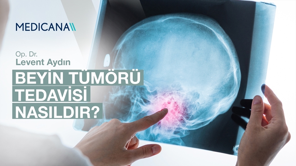 Beyin Tümörü Tedavisi Nasıldır?