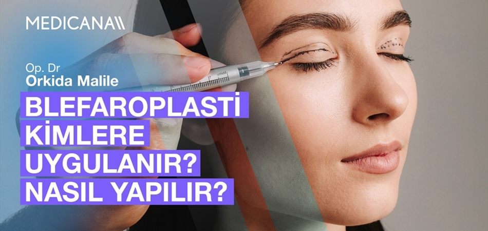 Blefaroplasti Kimlere Uygulanır? Nasıl Yapılır?