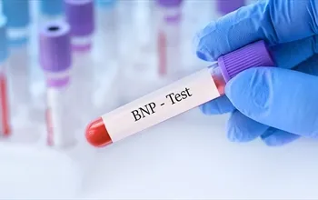 BNP nedir? Kalp yetersizliği tanısındaki rolü ve değerlendirilmesi