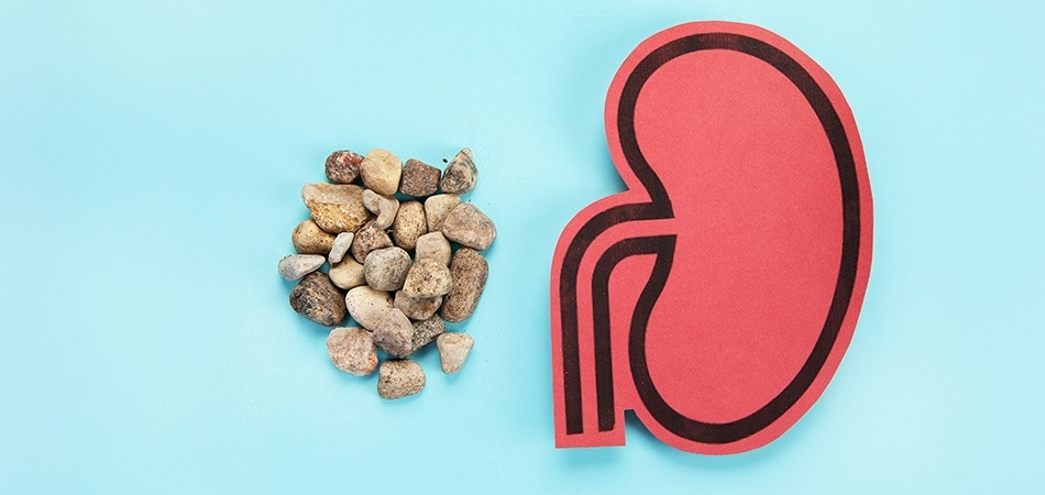 Hangi bitki böbrek taşını eritir? Böbrek taşı en hızlı nasıl düşer?