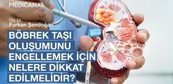 Böbrek Taşı Oluşumunu Engellemek İçin Nelere Dikkat Edilmelidir?