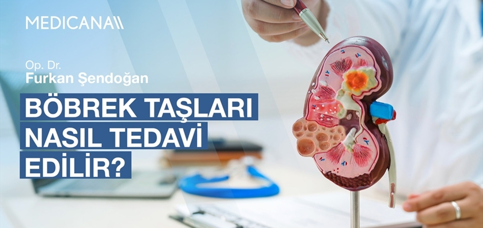 Böbrek Taşları Nasıl Tedavi Edilir?