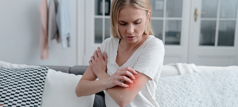 Böcek ısırıkları nasıl olur? Böcek ısırıkları için ne yapılır?