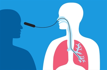 Bronkoskopi nedir? Neden uygulanır?