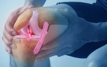 Çapraz bağ ameliyatı nedir? Çapraz bağ ameliyatı nasıl yapılır?