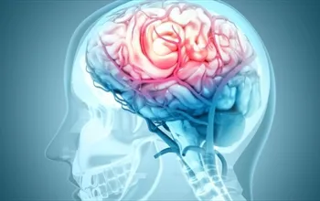 Serebrovasküler hastalık nedir? Serebrovasküler hastalık belirtileri nelerdir?