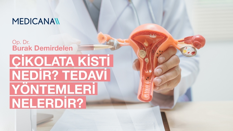 Çikolata Kisti Nedir? Belirtileri ve Tedavi Yöntemleri Nelerdir?