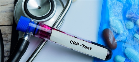 CRP nedir? CRP yüksekliği/düşüklüğü neyin göstergesidir?